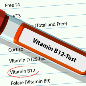 Vitamin Profile test