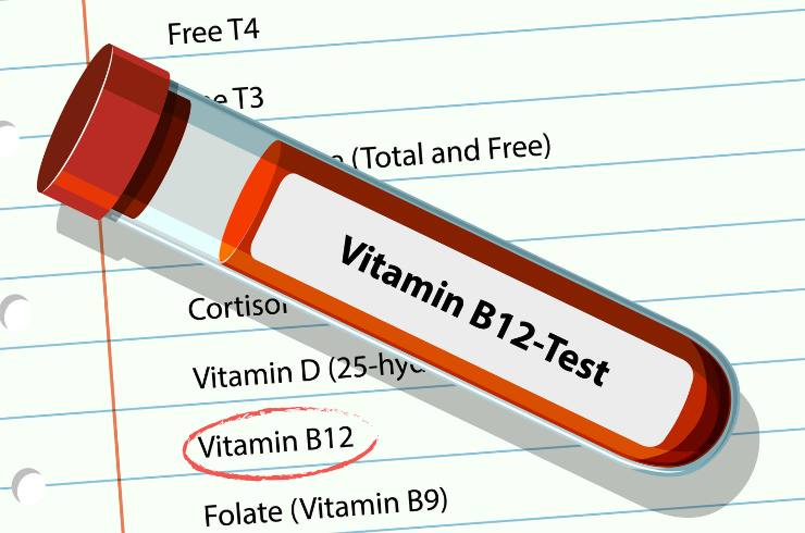 Vitamin Profile test