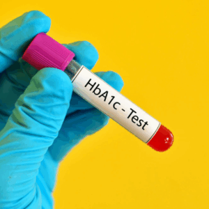 Smart Full Body Checkupwith HbA1c