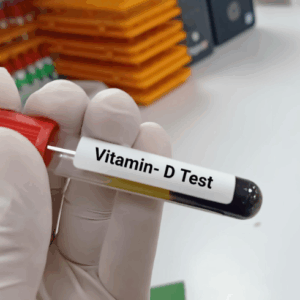Vitamin D and Vitamin B12Test