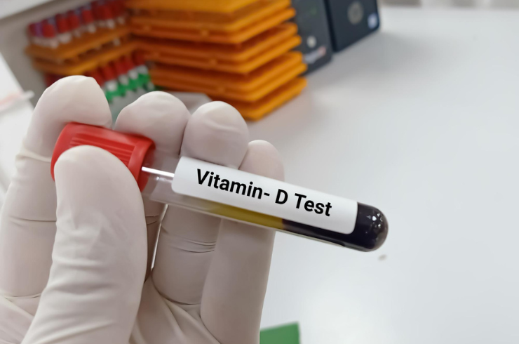 Vitamin D and Vitamin B12Test