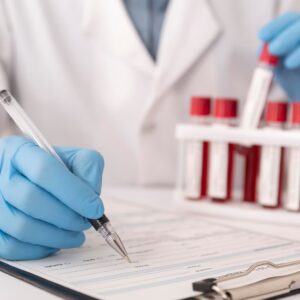 Smart Full Body checkup with D-dimer test